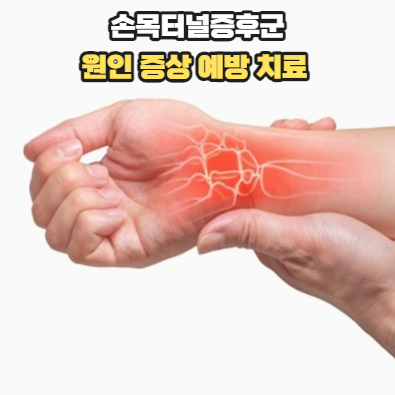 손목터널증후군 원인 증상 예방 치료