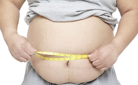 다낭성난소증후군과 비만